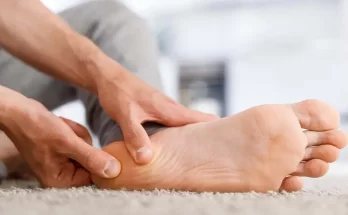 plantar fasciitis