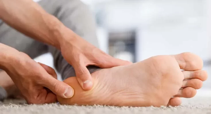 plantar fasciitis