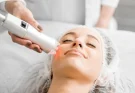 Pico Laser Treatment