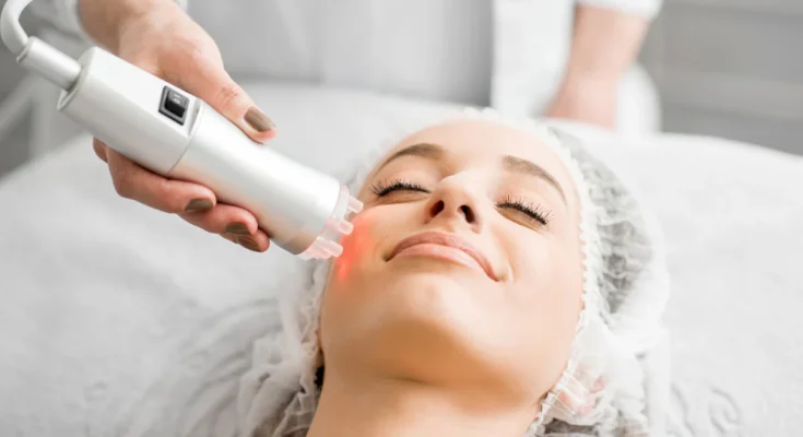 Pico Laser Treatment