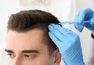 Hair Loss Treatment Centre Offers Comprehensive Evaluation And Tailored Growth Solutions